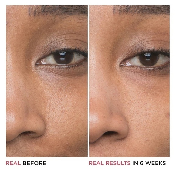 IT Cosmetics Bye Bye Pores 10% Glycolic Acid Serum - Picture 2 of 7